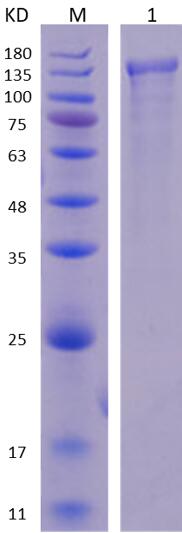 12% SDS-PAGE analysis profiles of purified NTHI0538-1-935 (CBB stained).